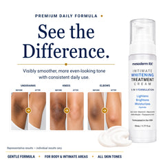 Mesoderm RX applied underarm demonstrating gentle use on intimate areas