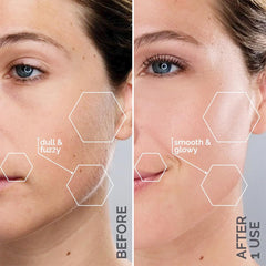 MICHAEL TODD Sonicsmooth with replaceable edges displaying hygiene and long-term use benefit