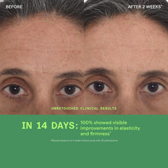 Murad hyaluronic acid concept image showing multi-depth hydration boost