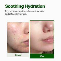 NACIFIC clear toner droplet on fingertip showing lightweight hydrating texture