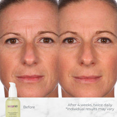 NASSIFMD serum texture on skin demonstrating lightweight feel and quick absorption benefit