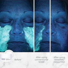 NassifMD single pad close-up wet with solution illustrating textured wipe benefit