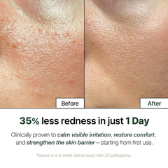 NATURAL DERMA PROJECT close-up of label highlighting centella and placenta actives for soothing