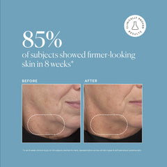 Naturium bakuchiol ingredient spotlight highlighting natural support for skin renewal benefits