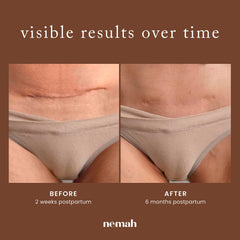 Nemah cream texture swiped on skin demonstrating fast absorption