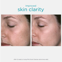NEOSTRATA gel texture on hand demonstrating smooth spreadability benefit