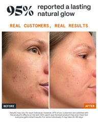 Norse Organics balm on face before and after showing reduced redness