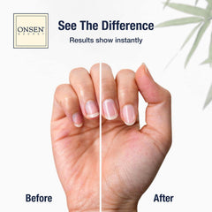 ONSEN cuticle serum dropper bottle demonstrating precise application benefit