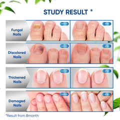 OSIMOON before and after comparison concept showing improved nails