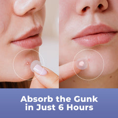 PatchRx patch on cheek during daytime illustrating subtle coverage under makeup