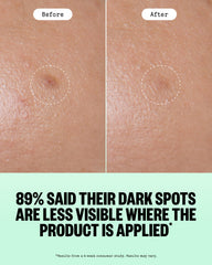 PEACE OUT dot applied to cheek demonstrating targeted spot treatment