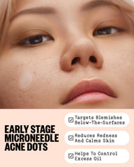 PEACE OUT textured microneedle detail demonstrating gentle delivery of actives