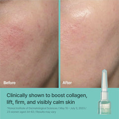 REJURAN ampoule application on face demonstrating soothing hydration benefits
