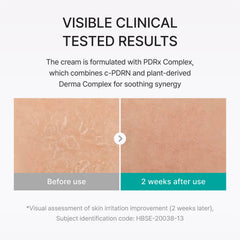 REJURAN dispensed cream on fingertip demonstrating easy application and moisture