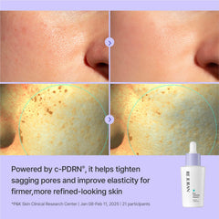 REJURAN ampoule held in hand showing size and easy dosing