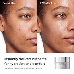 REJURAN cream applied on hand illustrating smooth absorption benefit