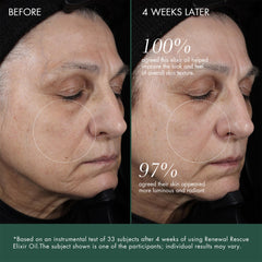 RéVive Rescue Elixir Oil dropper close-up illustrating precise application and nourishment