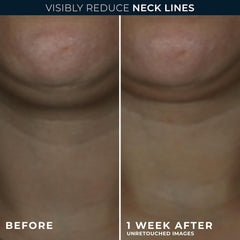 RoC neck cream open jar texture highlighting hydrating smoothness benefit