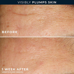 RoC front view of seven-count retinol capsule box offering a trial boost benefit