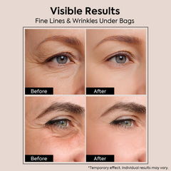 Scosvvi cream applied under eye demonstrating reduced puffiness