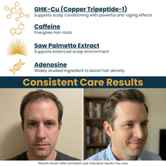 Seraphime application on scalp demonstrating targeted delivery benefit
