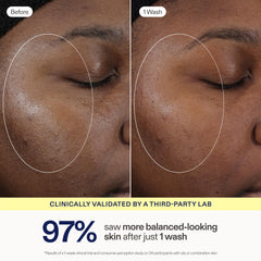 Skinfix kaolin clay ingredient visual highlighting oil-absorbing benefit