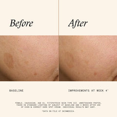 SkinMedica before and after comparison illustrating reduced dark spots and improved tone