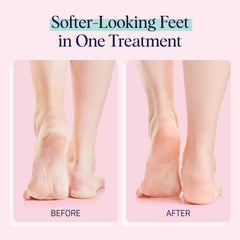 SpaLife overnight booties on bedside table suggesting deep repair while sleeping