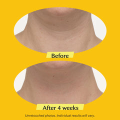 StriVectin being applied to neck demonstrating easy daily application