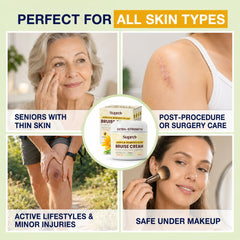 SupreH being applied to a hand to soothe a bruise