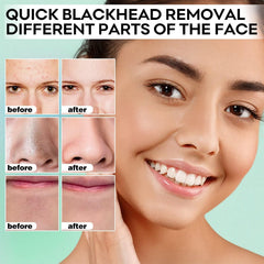 SYABO mask application on nose demonstrating easy use