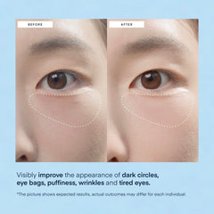 TEREZ & HONOR patch applied under eye demonstrating easy adhesion