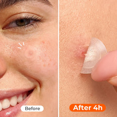TKTK hydrocolloid texture detail highlighting strong absorption
