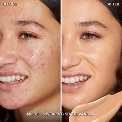 Too Faced wand applicator demonstrating precise application for blemish coverage