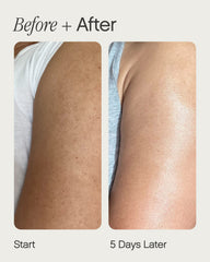 Topicals Slather applied on arm demonstrating smoother-looking skin and reduced bumps