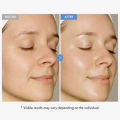 TOSOWOONG cream applied on hand demonstrating fast absorption and plumping