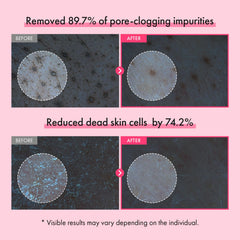 TOSOWOONG pink capsules detail highlighting blackhead-lifting action