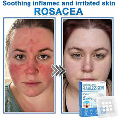 UYOUSC patch applied on cheek demonstrating secure adherence and protection