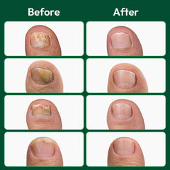 VERDORA hand holding patch to show size and easy application benefit
