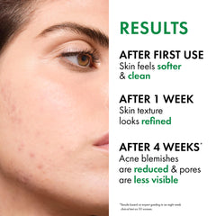 VICHY Normaderm salicylic acid ingredient visual highlighting pore-clearing benefit