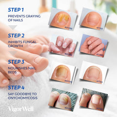 VigorWell patch being applied to a clean toenail for easy use