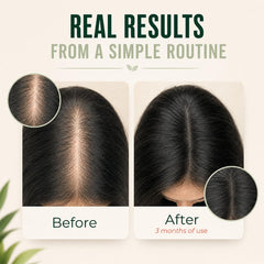 Vitamo Batana applied to scalp promoting targeted nourishment
