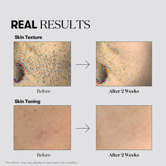 VT COSMETICS sheet mask on model showing comfortable fit and even coverage