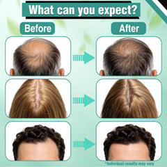 Wachinas application on scalp demonstration showing targeted placement benefits