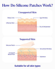 Wrinkles Schminkles side profile before and after showing visible smoothing