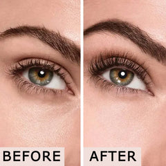 youngfocus gel tube applicator close-up demonstrating precise application