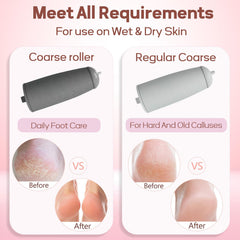 ZABOUL in use on heel showing gentle callus removal for smoother skin