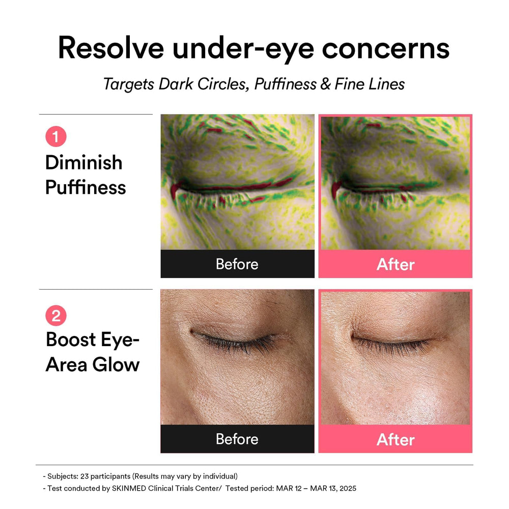 Model applying Abib patch under-eye for immediate cooling and refreshed look