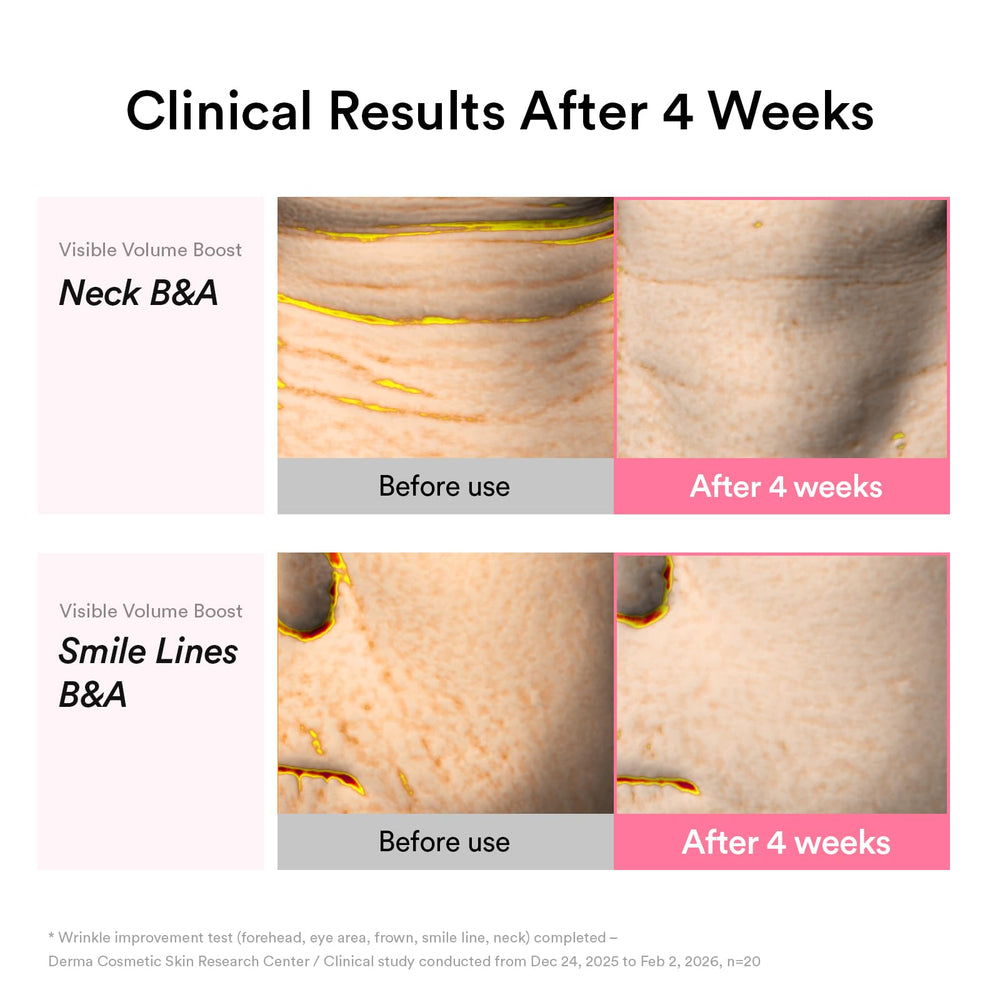 Abib being dabbed into smile lines to help restore facial contour