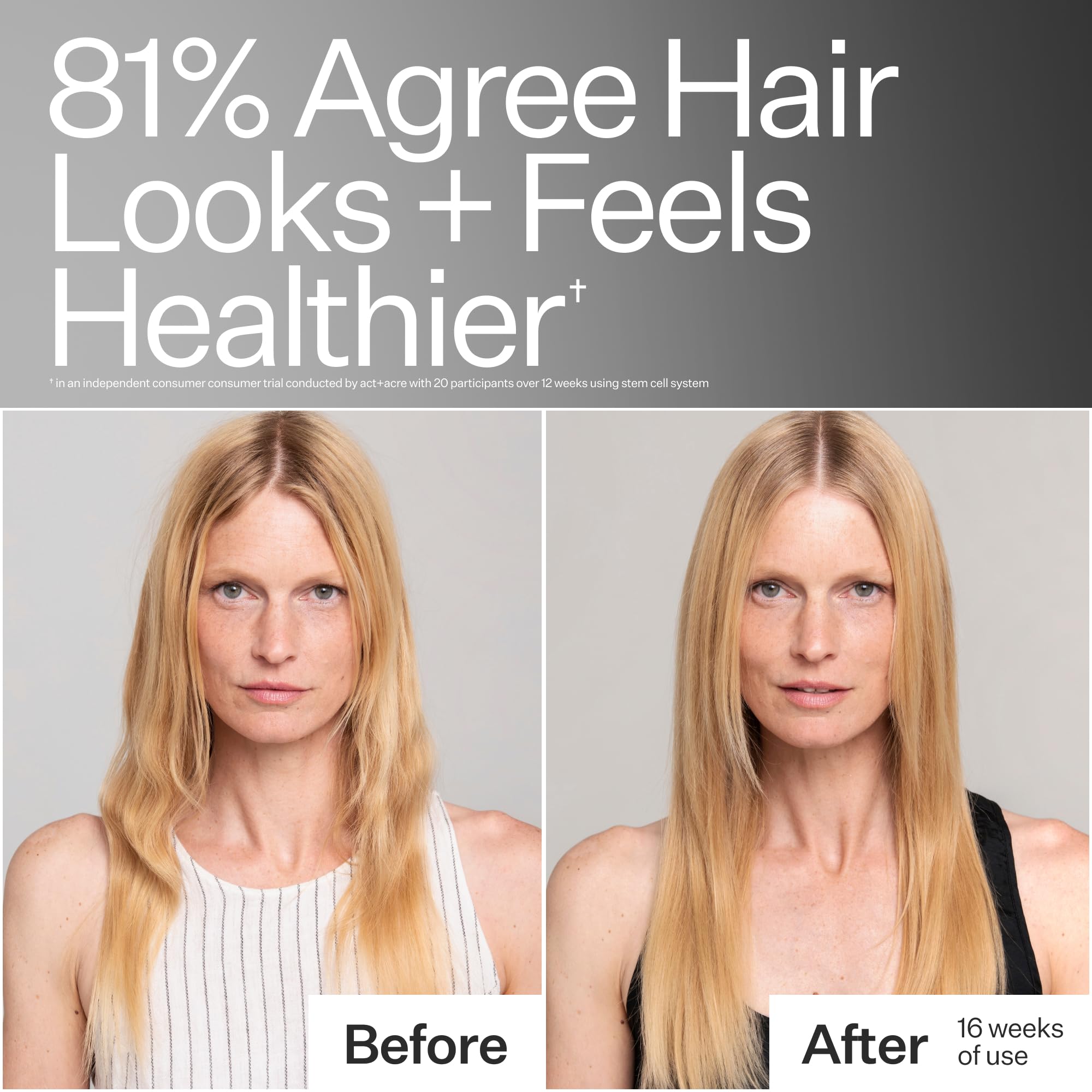 ACT+ ACRE close-up of Swiss Apple Stem Cells and ingredients supporting follicles